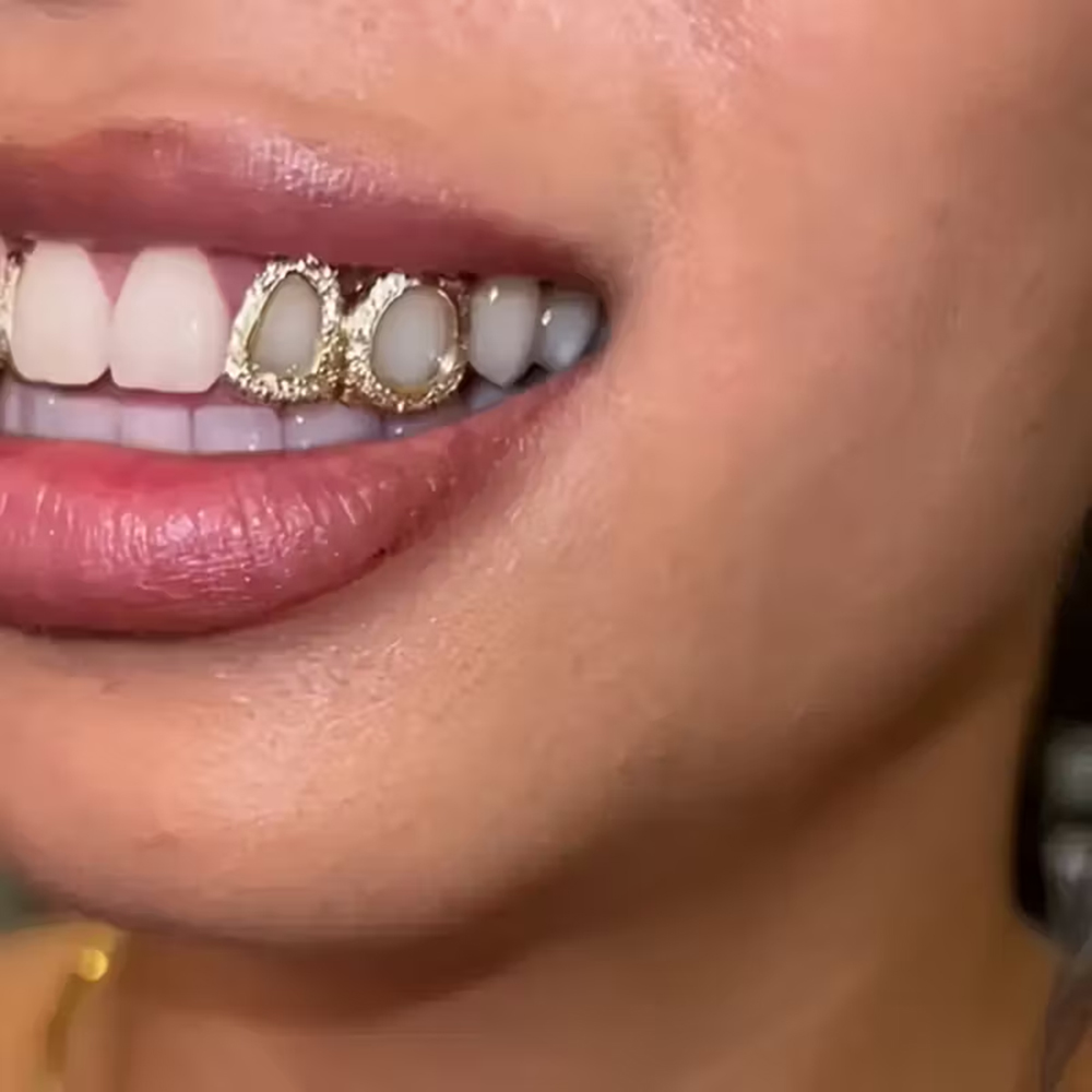 Acessório de Dentes Brilhantes - Street Fashion Jewelry avaliação e preço
